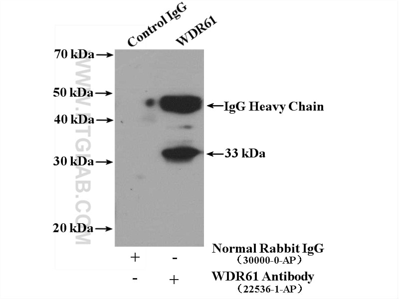 Immunoprecipitation (IP) experiment of mouse brain tissue using WDR61 Polyclonal antibody (22536-1-AP)