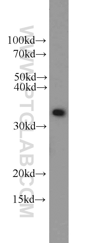 Western Blot (WB) analysis of HeLa cells using WDR61 Polyclonal antibody (22536-1-AP)