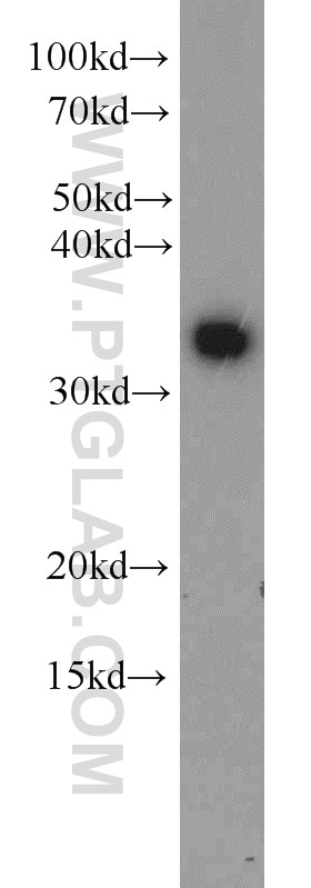 Western Blot (WB) analysis of mouse liver tissue using WDR61 Polyclonal antibody (22536-1-AP)