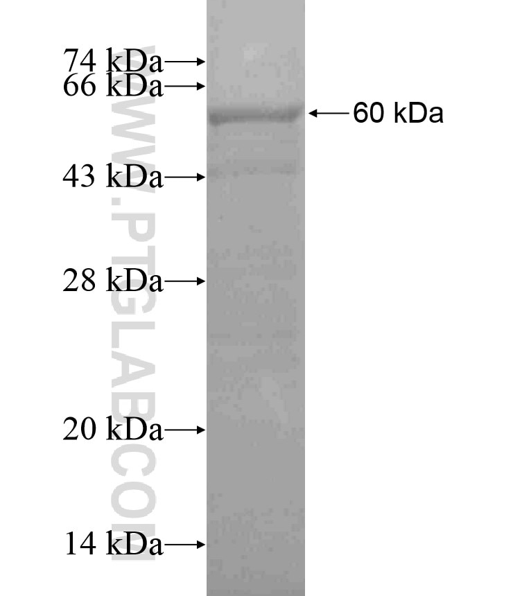 WDR61 fusion protein Ag18215 SDS-PAGE