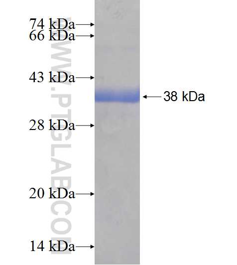WDR61 fusion protein Ag18443 SDS-PAGE