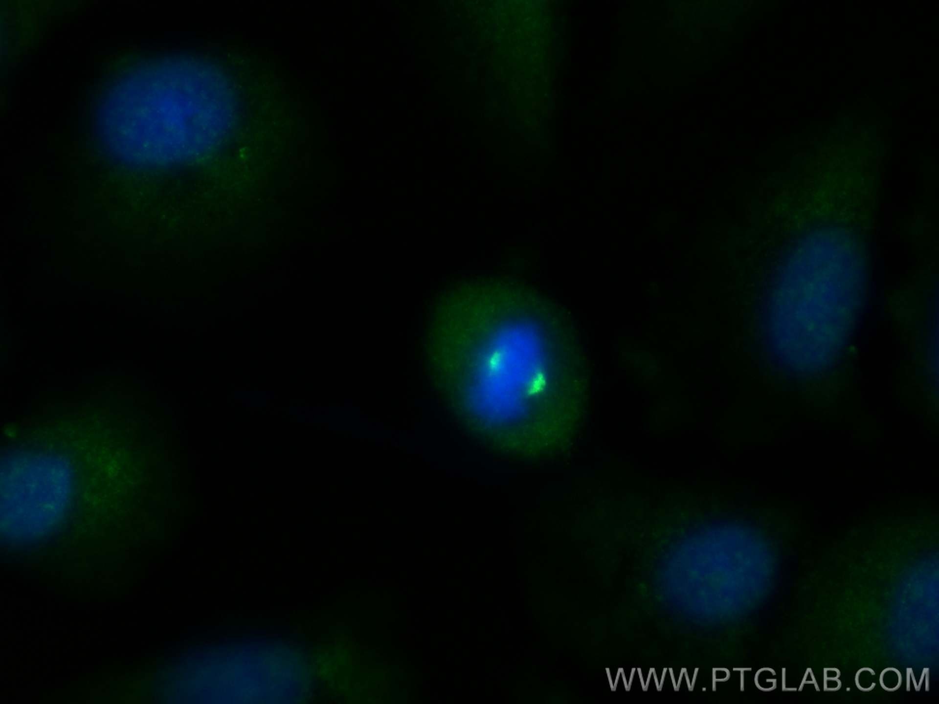 Immunofluorescence (IF) / fluorescent staining of A549 cells using WDR62 Polyclonal antibody (23404-1-AP)