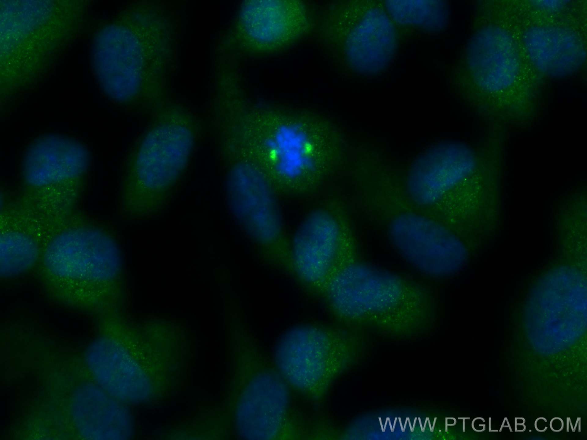 Immunofluorescence (IF) / fluorescent staining of hTERT-RPE1 cells using WDR62 Polyclonal antibody (23404-1-AP)
