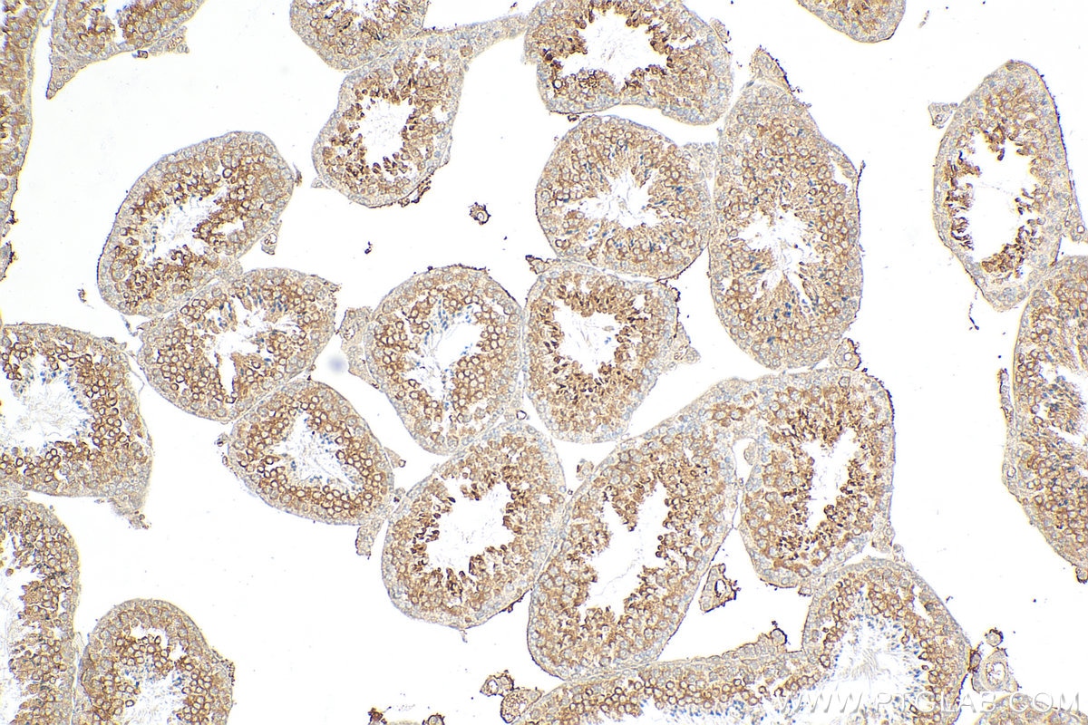 Immunohistochemistry (IHC) staining of mouse testis tissue using WDR62 Polyclonal antibody (23404-1-AP)