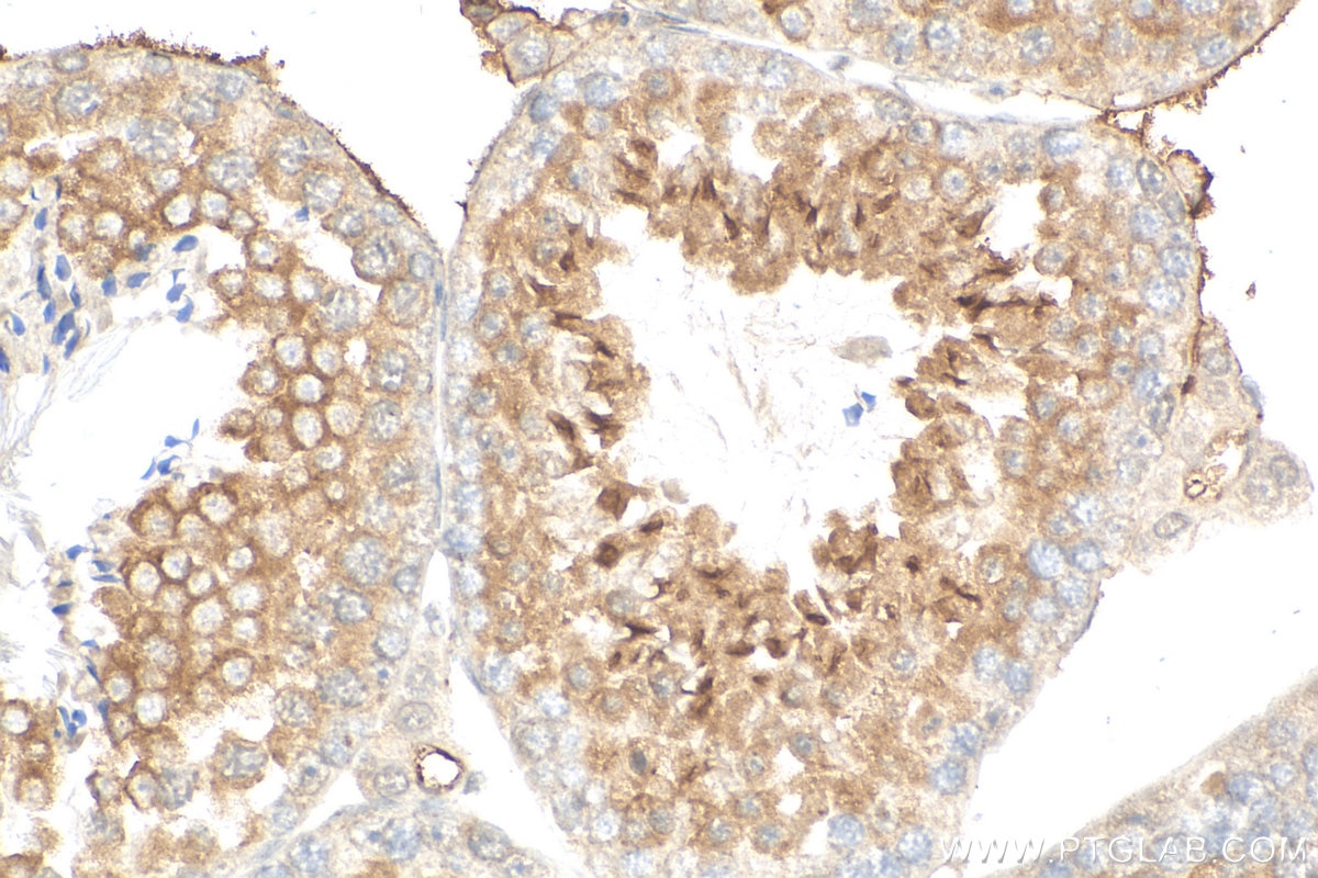 Immunohistochemistry (IHC) staining of mouse testis tissue using WDR62 Polyclonal antibody (23404-1-AP)