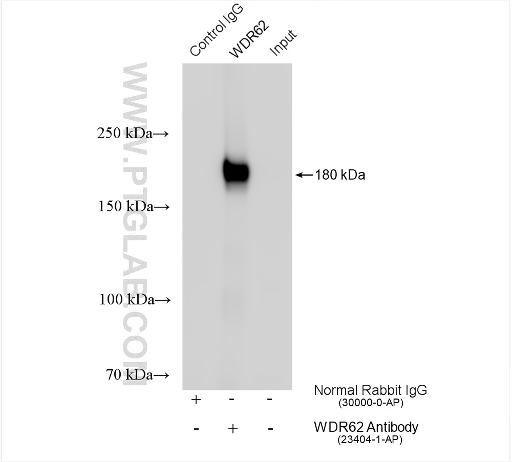 Immunoprecipitation (IP) experiment of HEK-293T cells using WDR62 Polyclonal antibody (23404-1-AP)