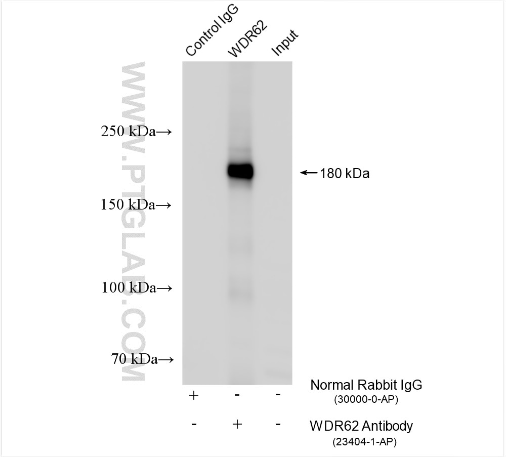 Immunoprecipitation (IP) experiment of HEK-293T cells using WDR62 Polyclonal antibody (23404-1-AP)