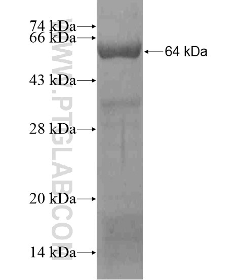 WDR62 fusion protein Ag19865 SDS-PAGE