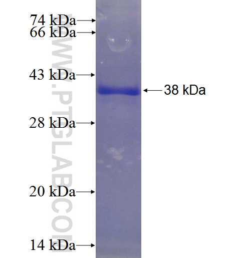 WDR69 fusion protein Ag23664 SDS-PAGE