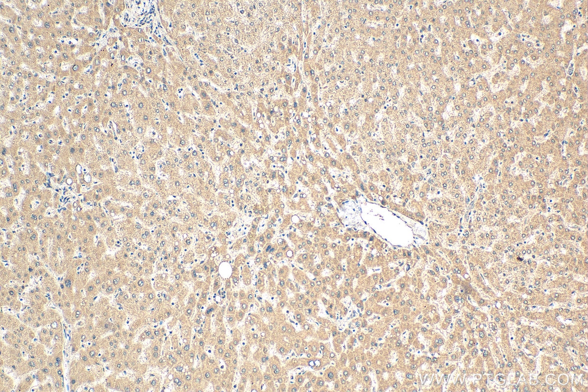 Immunohistochemistry (IHC) staining of human liver tissue using WDR7 Polyclonal antibody (24431-1-AP)