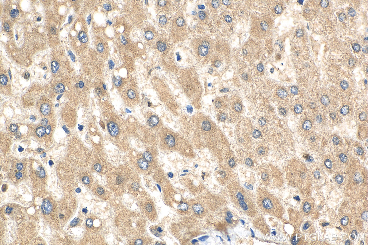 Immunohistochemistry (IHC) staining of human liver tissue using WDR7 Polyclonal antibody (24431-1-AP)