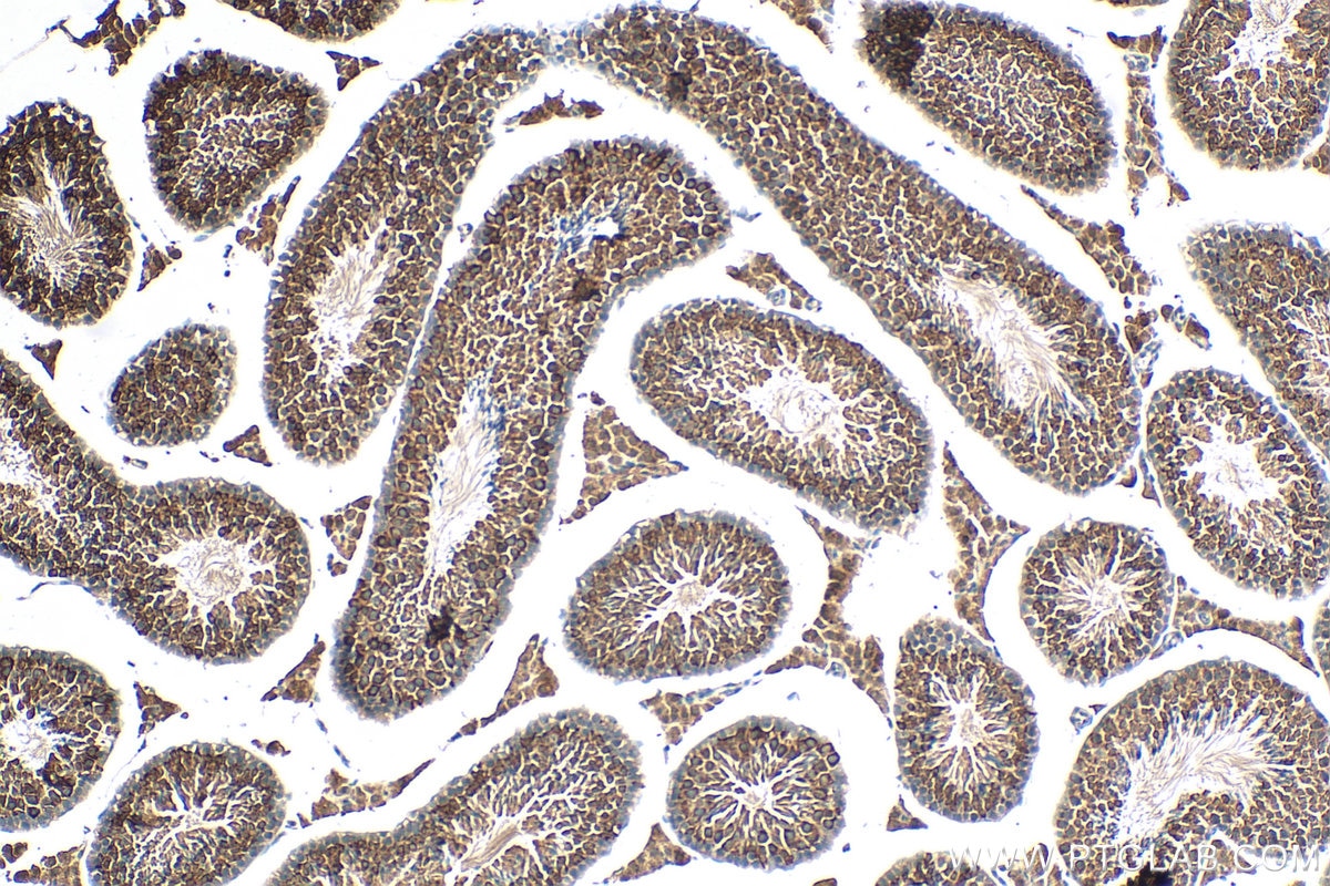 Immunohistochemistry (IHC) staining of mouse testis tissue using WDR7 Polyclonal antibody (24431-1-AP)