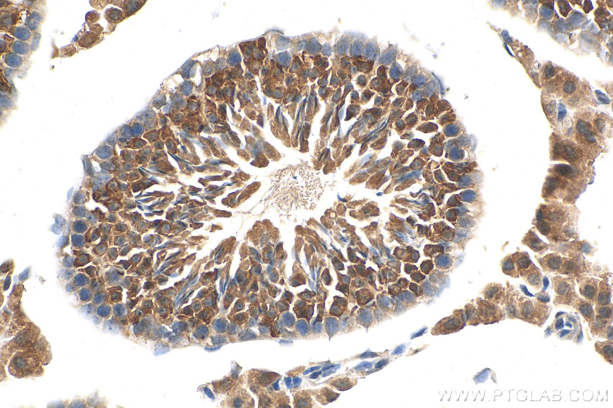 Immunohistochemistry (IHC) staining of mouse testis tissue using WDR7 Polyclonal antibody (24431-1-AP)