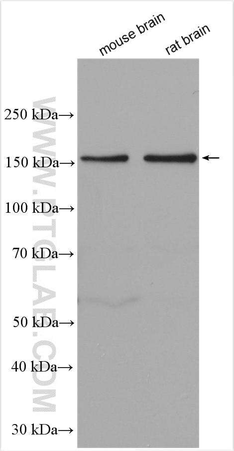 Western Blot (WB) analysis of various lysates using WDR7 Polyclonal antibody (24431-1-AP)