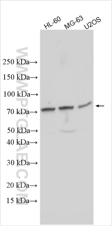 Western Blot (WB) analysis of various lysates using WDR70 Polyclonal antibody (33145-1-AP)