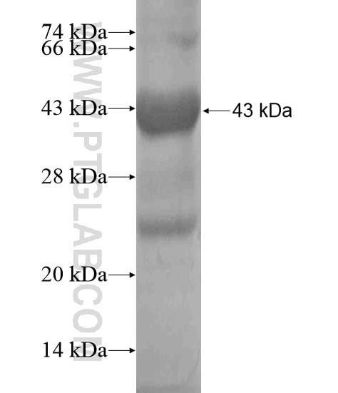 WDR72 fusion protein Ag19908 SDS-PAGE