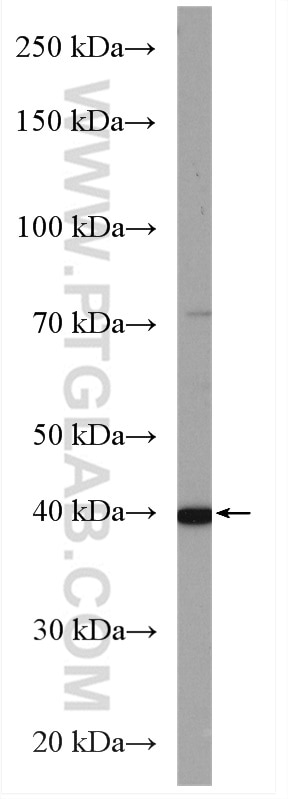 WB analysis of HepG2 using 20631-1-AP