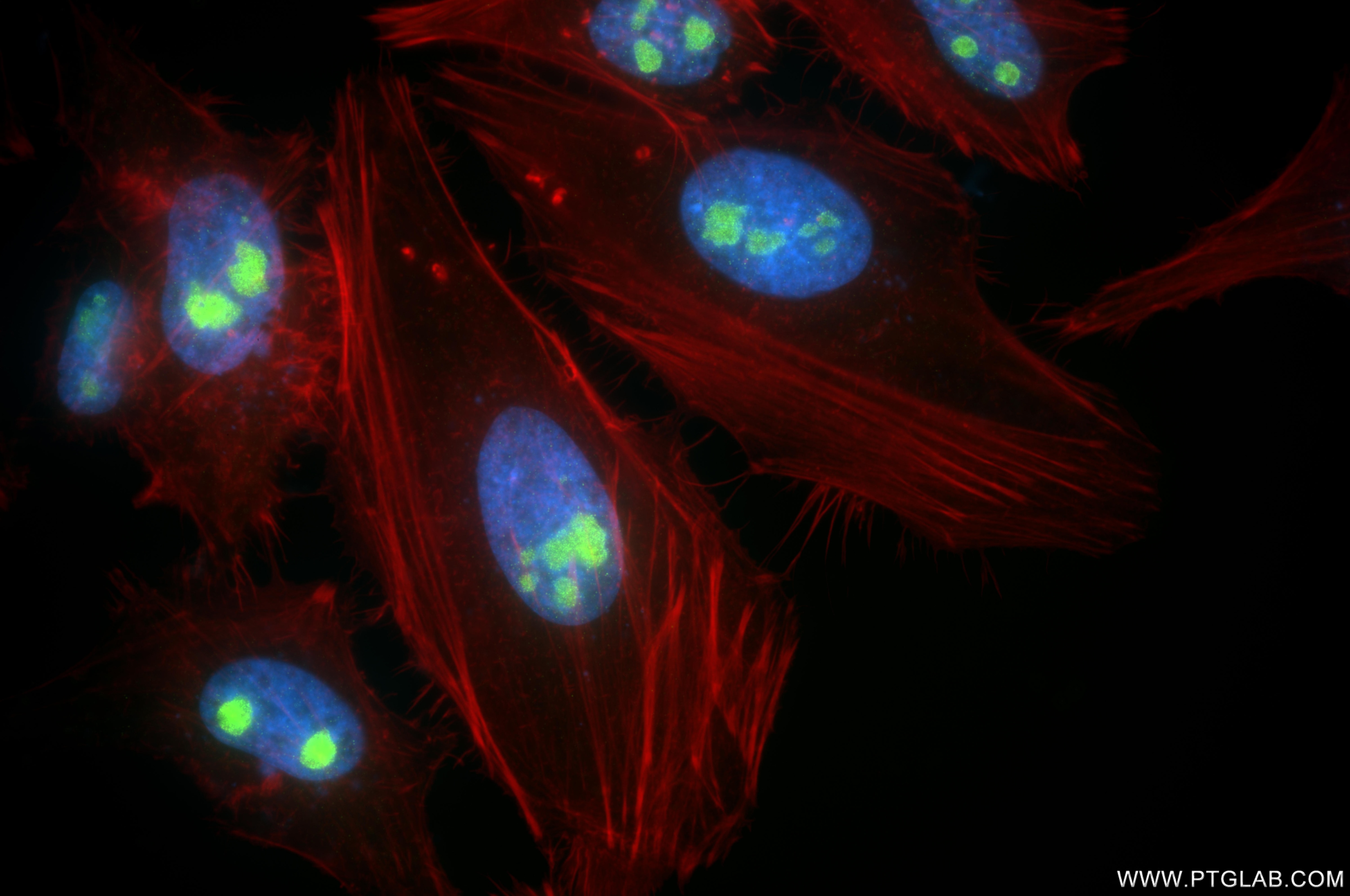 Immunofluorescence (IF) / fluorescent staining of HeLa cells using WDR74 Recombinant monoclonal antibody (86361-2-RR)