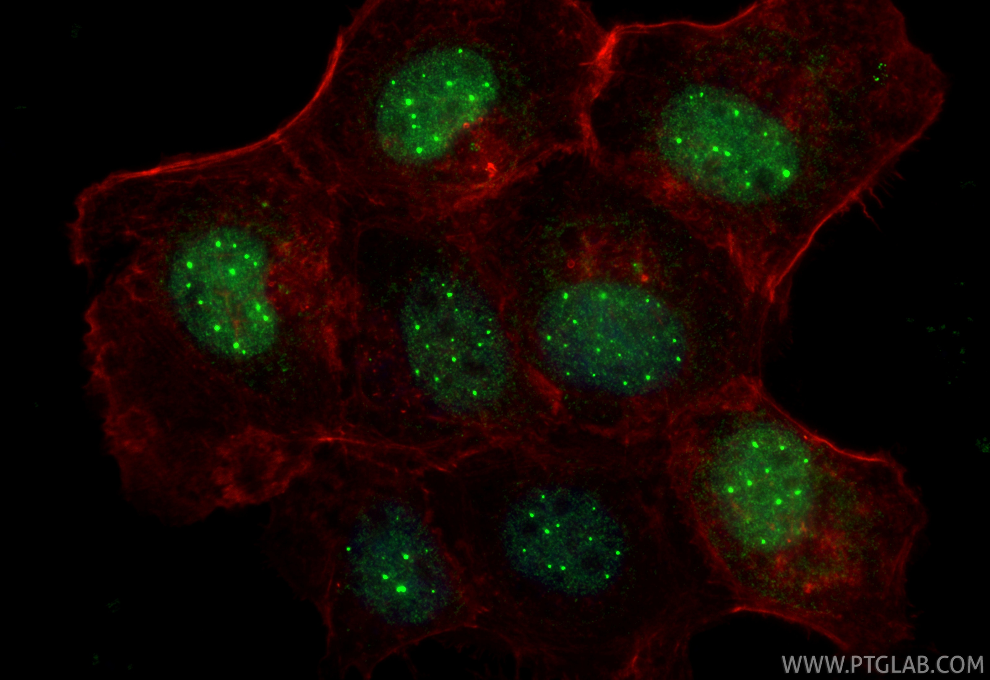 Immunofluorescence (IF) / fluorescent staining of A431 cells using WDR76 Polyclonal antibody (25528-1-AP)