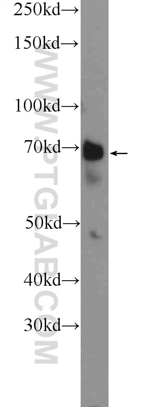 Western Blot (WB) analysis of HeLa cells using WDR76 Polyclonal antibody (25528-1-AP)