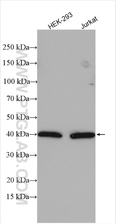 Western Blot (WB) analysis of various lysates using WDR77 Polyclonal antibody (10115-1-AP)