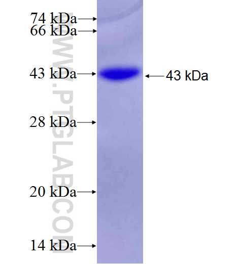 WDR78 fusion protein Ag27018 SDS-PAGE