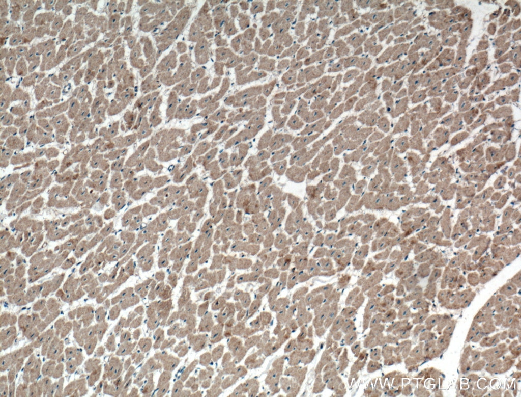 Immunohistochemistry (IHC) staining of human heart tissue using WDR8 Polyclonal antibody (27628-1-AP)