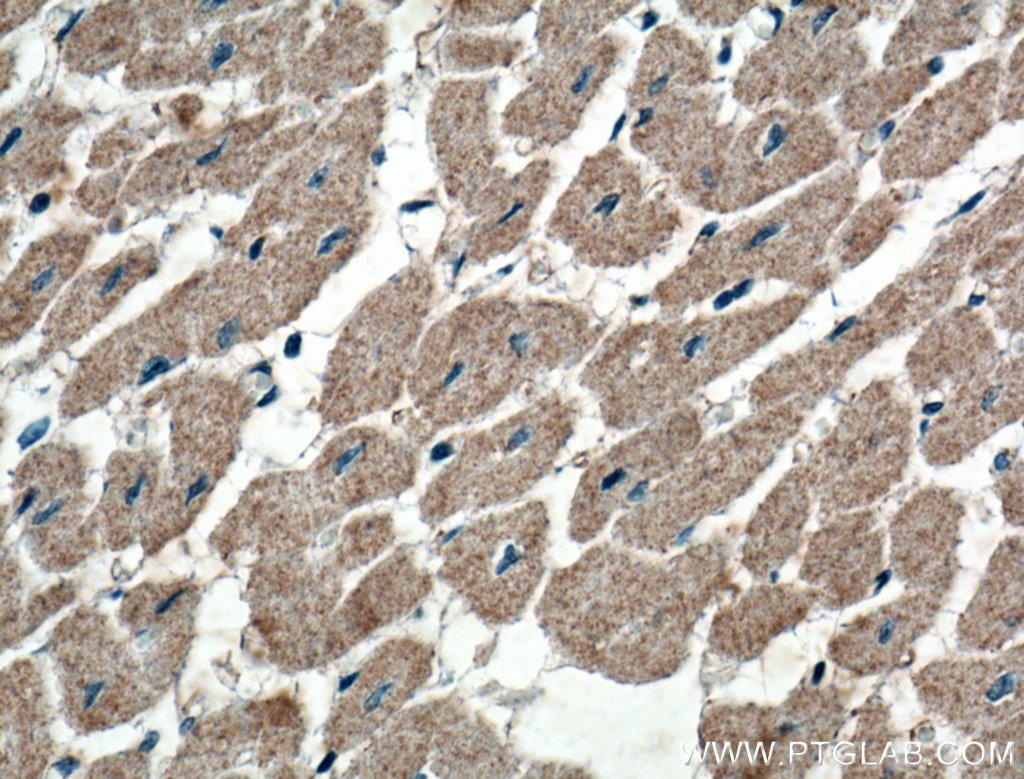 Immunohistochemistry (IHC) staining of human heart tissue using WDR8 Polyclonal antibody (27628-1-AP)