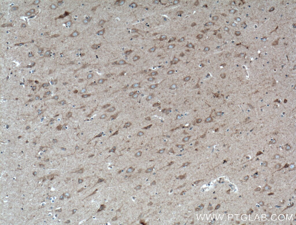 Immunohistochemistry (IHC) staining of human brain tissue using WDR8 Polyclonal antibody (27628-1-AP)