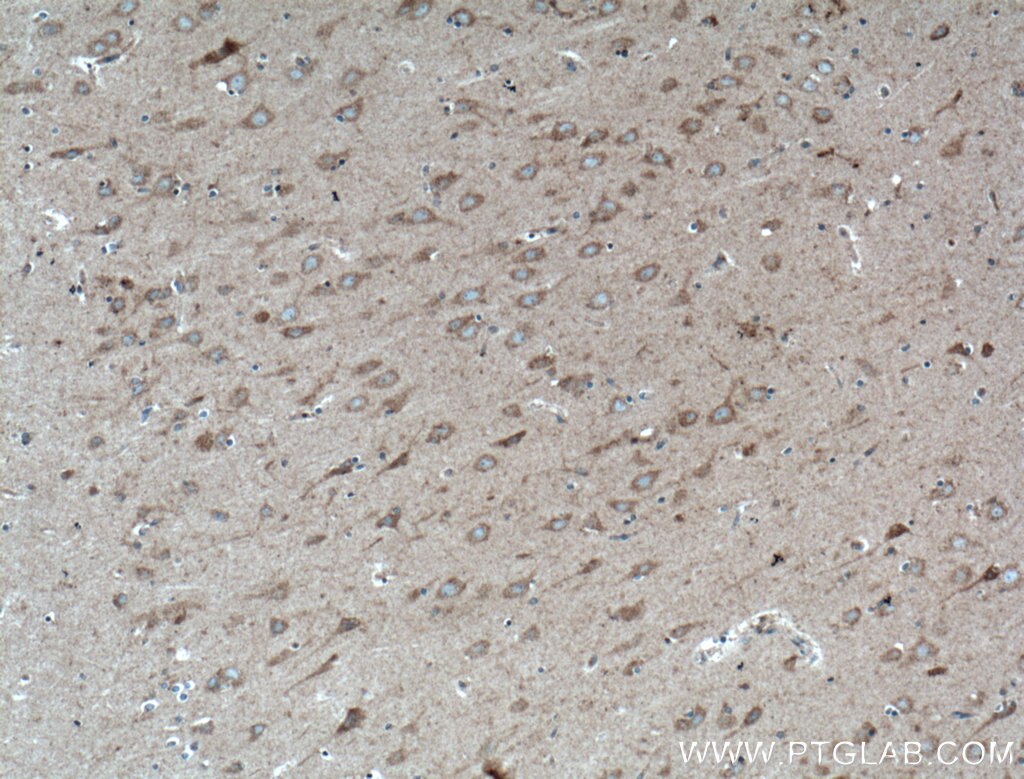 Immunohistochemistry (IHC) staining of human brain tissue using WDR8 Polyclonal antibody (27628-1-AP)