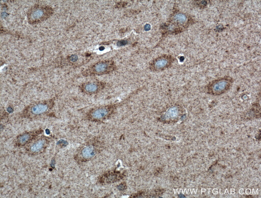 Immunohistochemistry (IHC) staining of human brain tissue using WDR8 Polyclonal antibody (27628-1-AP)