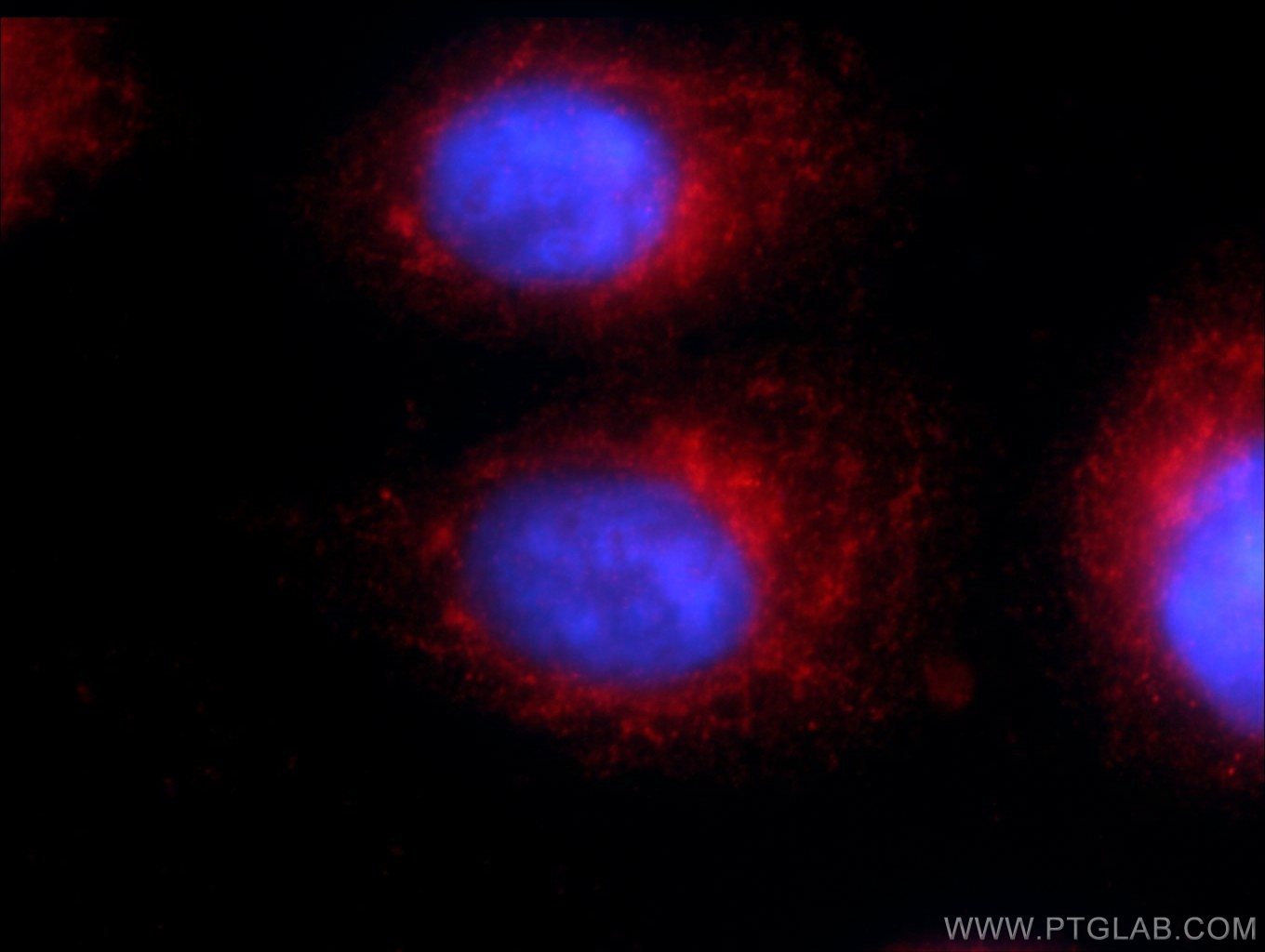 Immunofluorescence (IF) / fluorescent staining of HepG2 cells using WDR81 Polyclonal antibody (24874-1-AP)