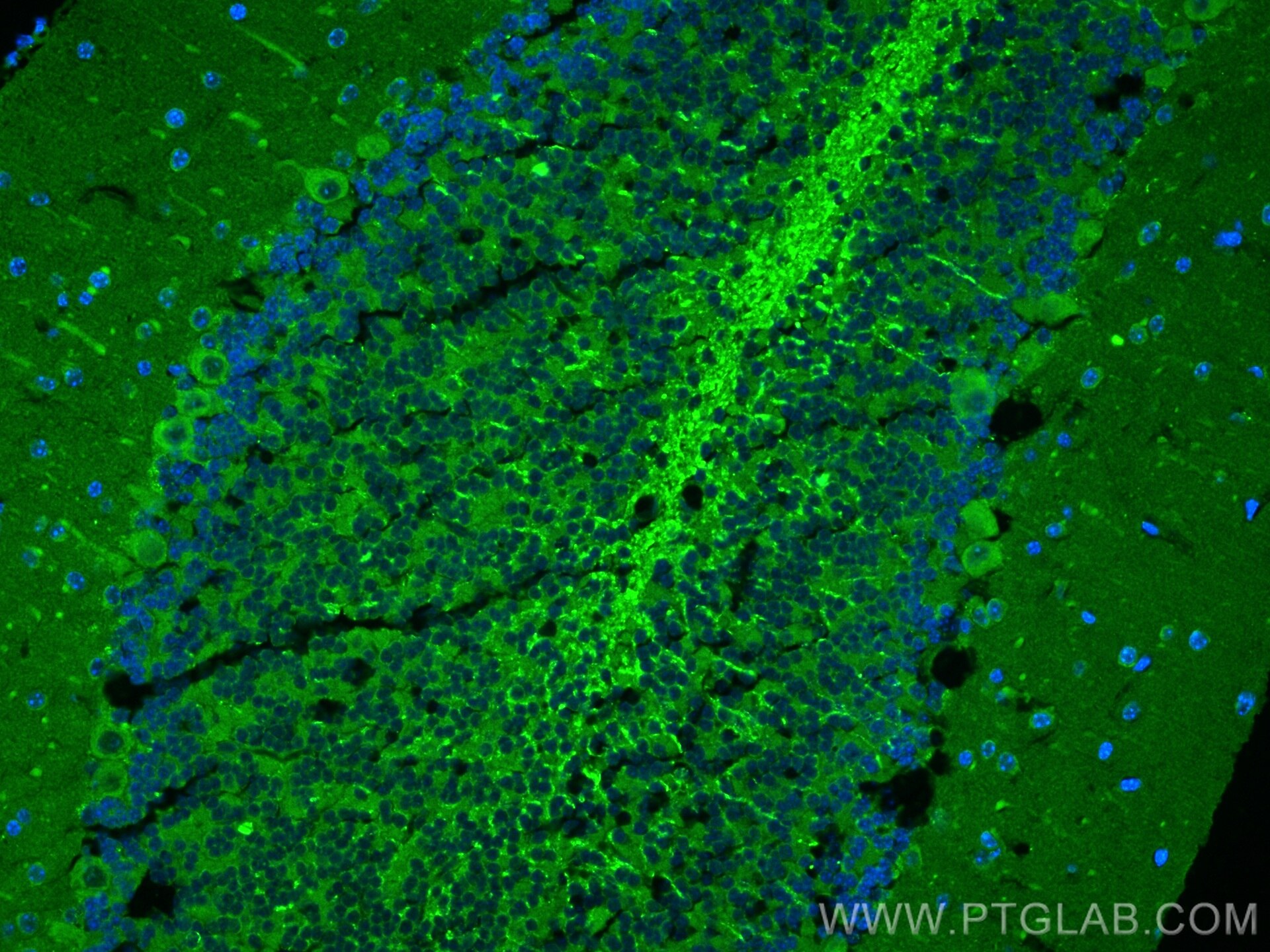 Immunofluorescence (IF) / fluorescent staining of mouse cerebellum tissue using WDR81 Polyclonal antibody (24874-1-AP)
