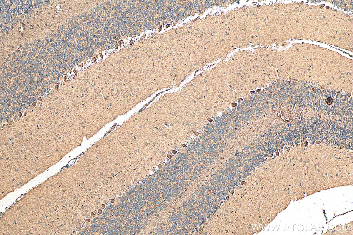 Immunohistochemistry (IHC) staining of mouse cerebellum tissue using WDR81 Polyclonal antibody (24874-1-AP)