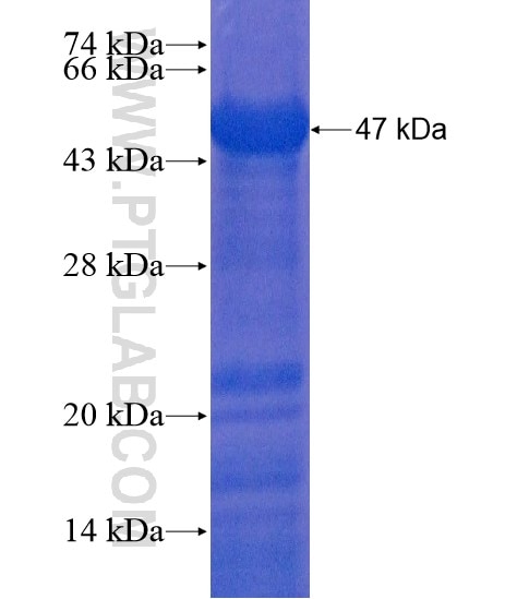 WDR81 fusion protein Ag21666 SDS-PAGE