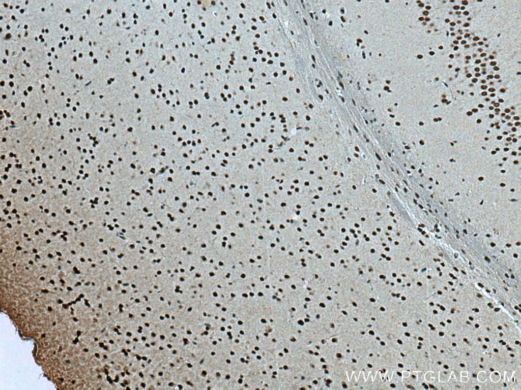 Immunohistochemistry (IHC) staining of mouse brain tissue using WDR82 Polyclonal antibody (21354-1-AP)