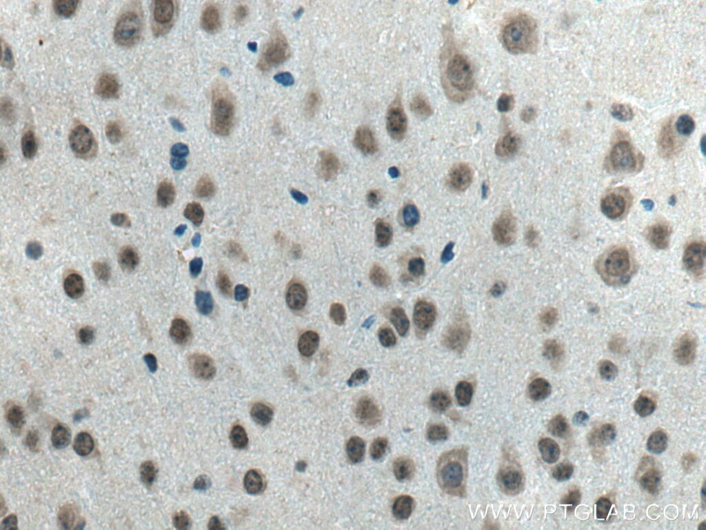 Immunohistochemistry (IHC) staining of mouse brain tissue using WDR82 Polyclonal antibody (21354-1-AP)
