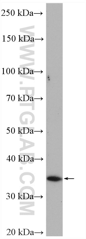 Western Blot (WB) analysis of HL-60 cells using WDR82 Polyclonal antibody (21354-1-AP)