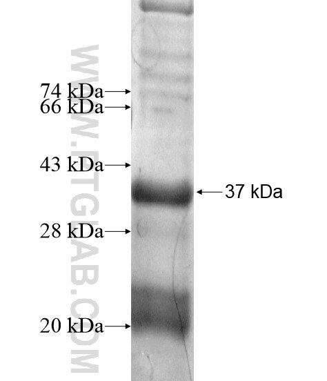 WDR82 fusion protein Ag15578 SDS-PAGE