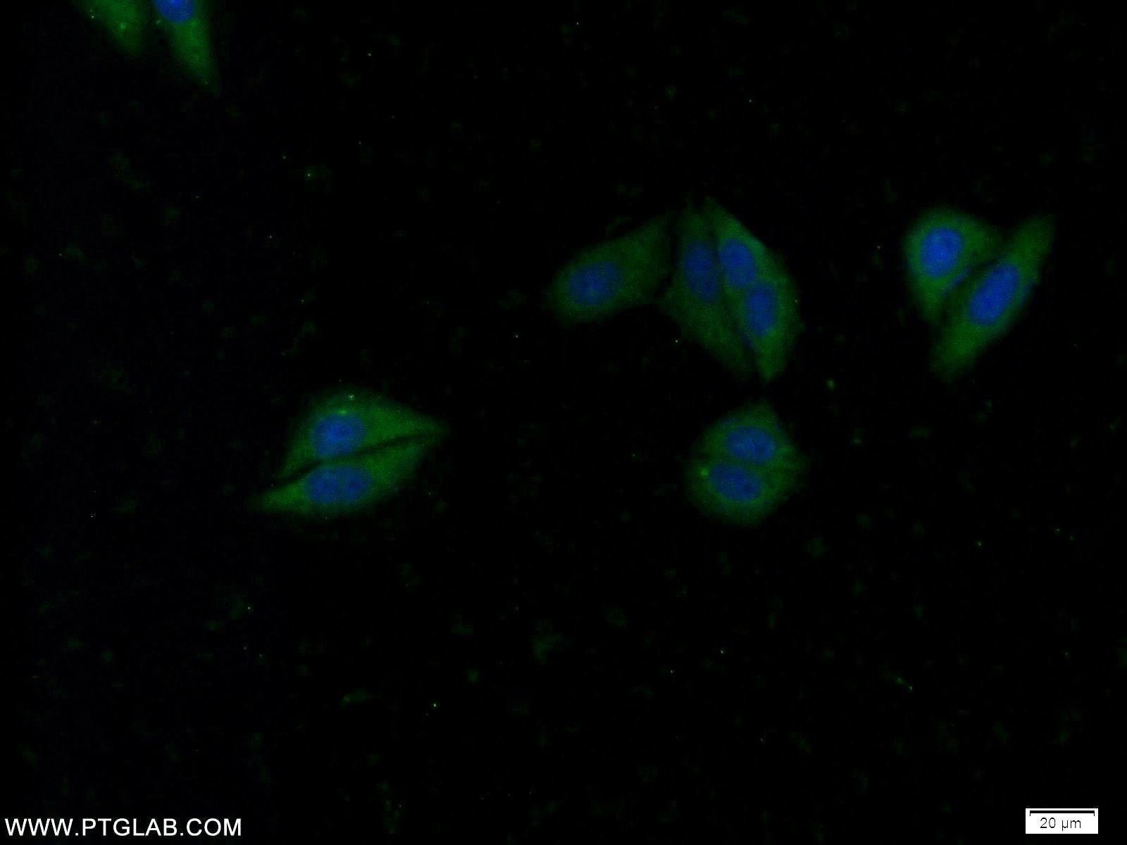 Immunofluorescence (IF) / fluorescent staining of HepG2 cells using WDR92 Polyclonal antibody (25540-1-AP)