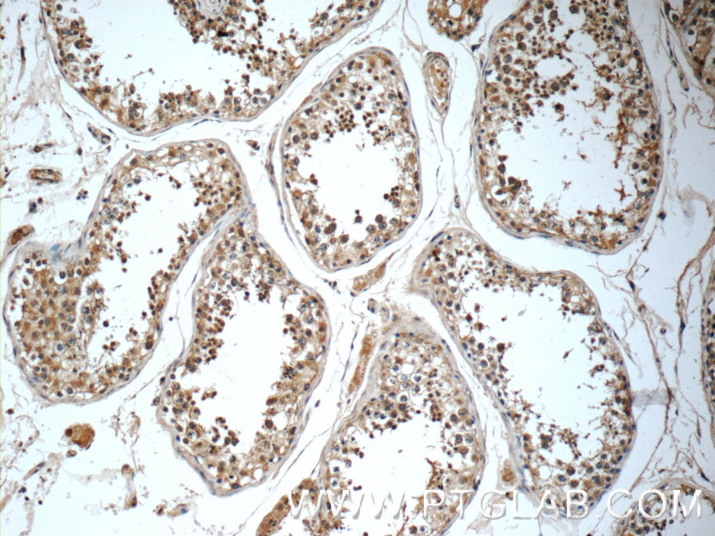 IHC staining of human testis using 25540-1-AP