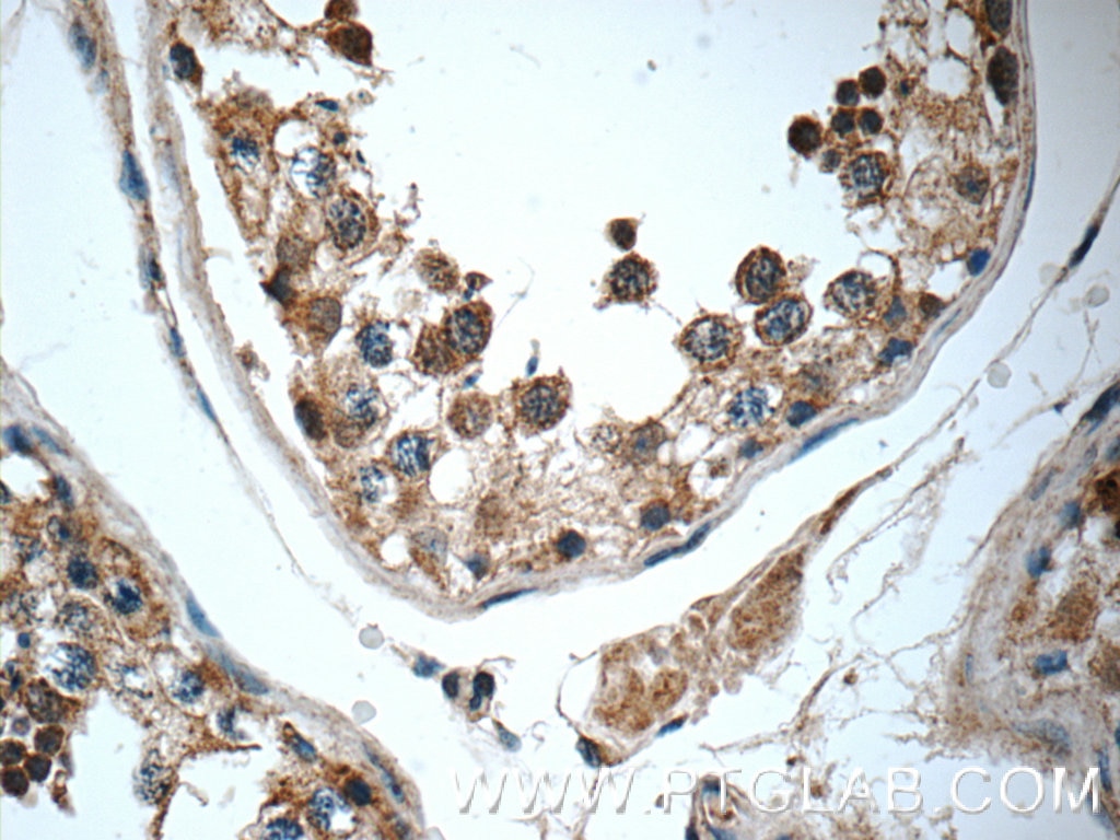 Immunohistochemistry (IHC) staining of human testis tissue using WDR92 Polyclonal antibody (25540-1-AP)