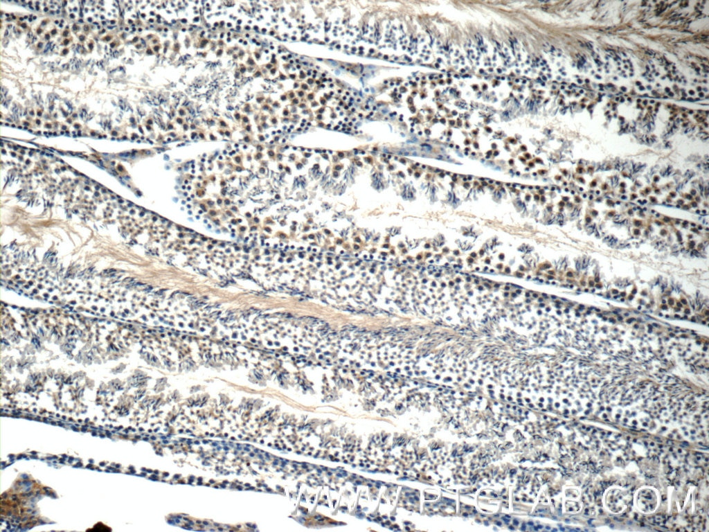 Immunohistochemistry (IHC) staining of mouse testis tissue using WDR92 Polyclonal antibody (25540-1-AP)