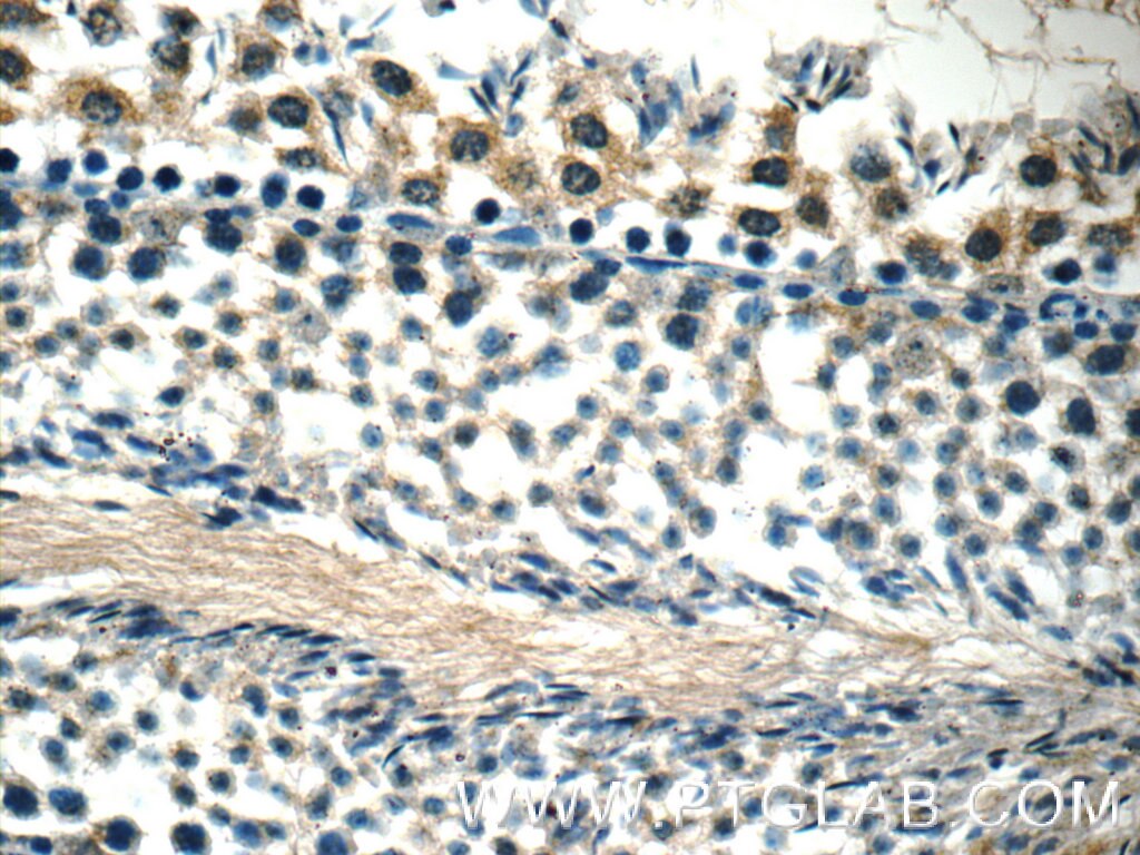 Immunohistochemistry (IHC) staining of mouse testis tissue using WDR92 Polyclonal antibody (25540-1-AP)