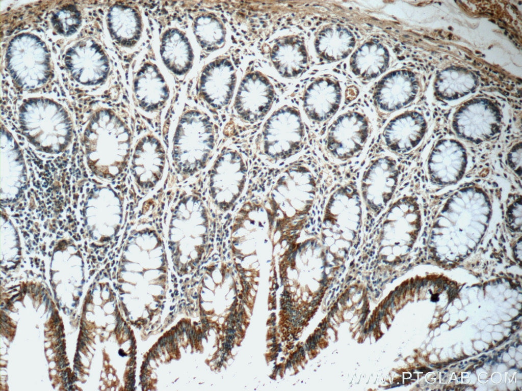 Immunohistochemistry (IHC) staining of human colon tissue using WDR92 Polyclonal antibody (25540-1-AP)