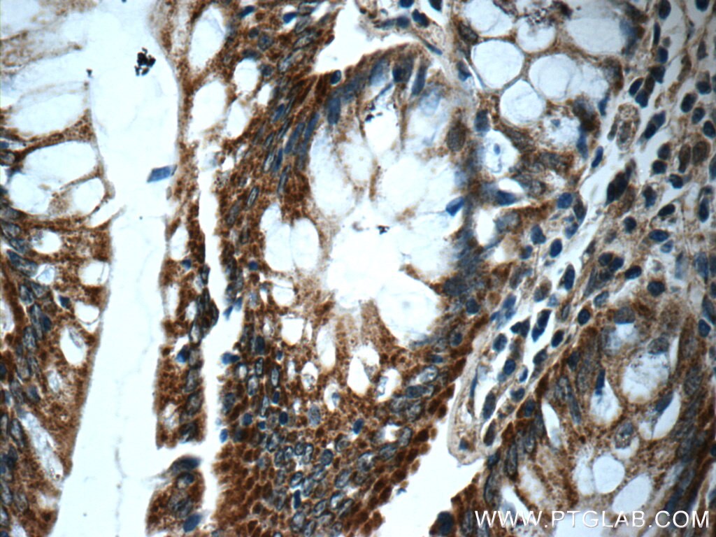 Immunohistochemistry (IHC) staining of human colon tissue using WDR92 Polyclonal antibody (25540-1-AP)