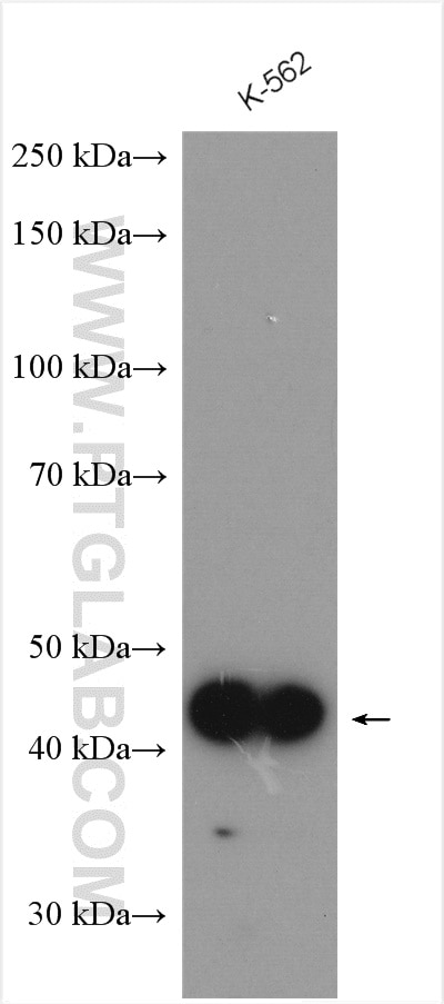 Western Blot (WB) analysis of various lysates using WDR92 Polyclonal antibody (25540-1-AP)
