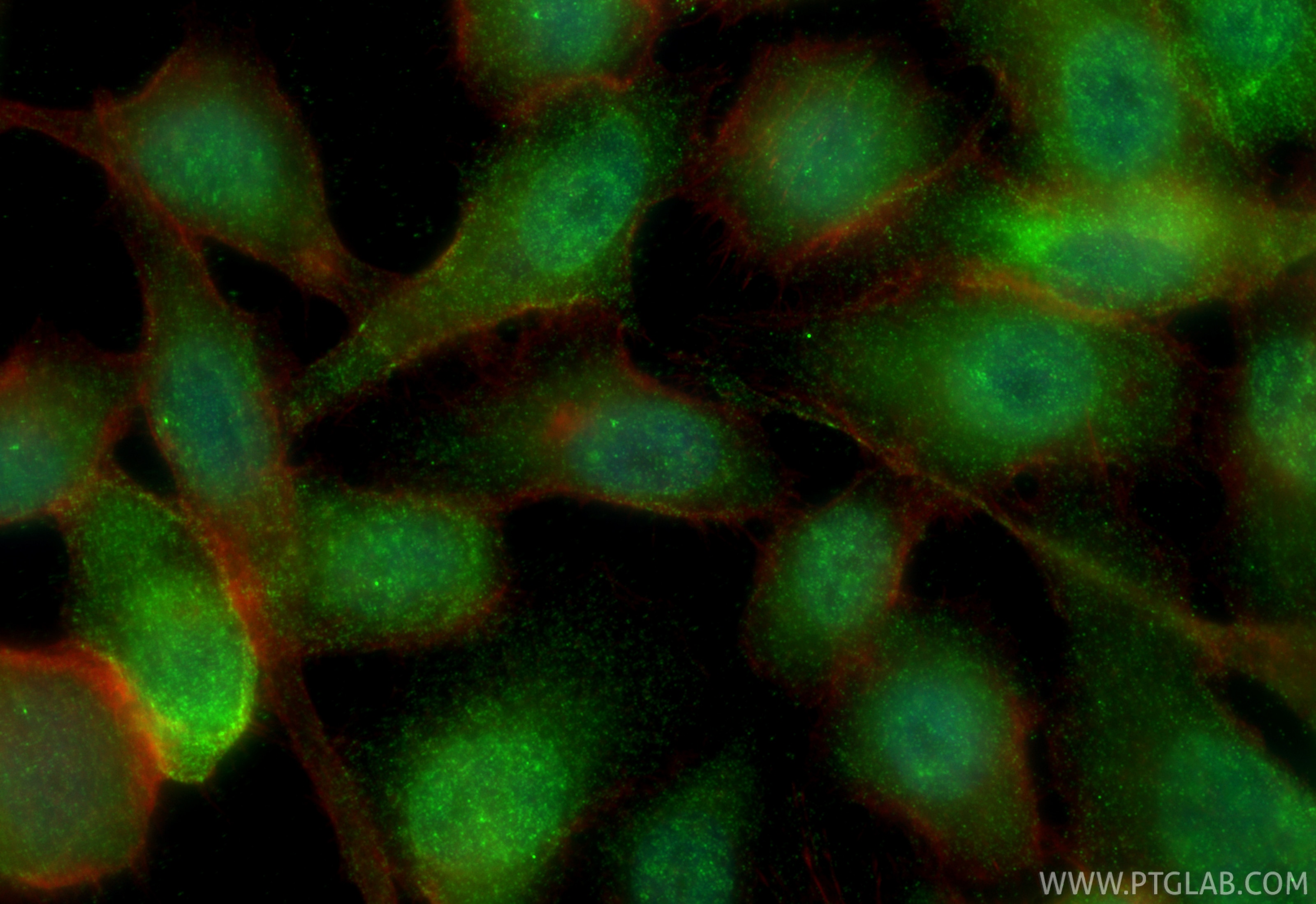 Immunofluorescence (IF) / fluorescent staining of PC-3 cells using WDSOF1 Polyclonal antibody (33483-1-AP)