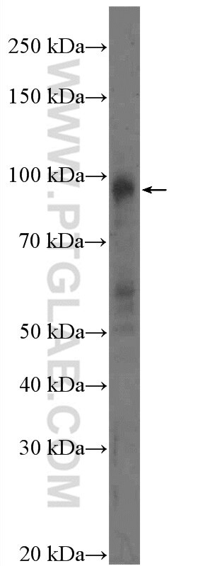 WEE1 Polyclonal antibody