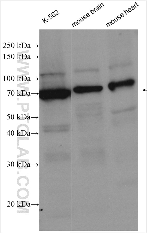 Western Blot (WB) analysis of various lysates using WEE1 Polyclonal antibody (29474-1-AP)